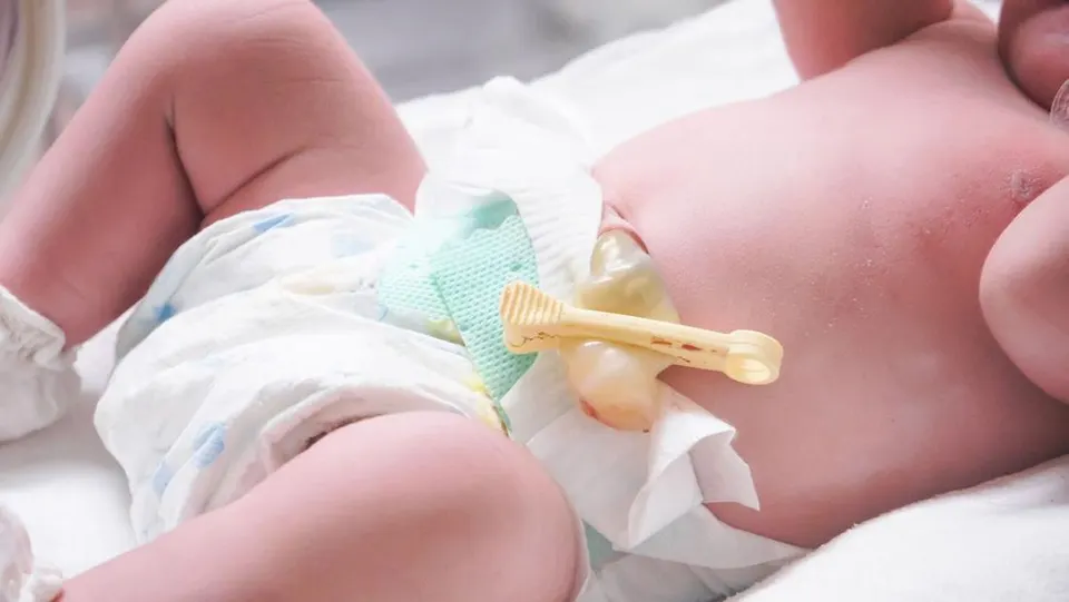 Eks Perawat dan Rekannya Ditangkap Usai Culik Bayi di RSU Sundari Medan